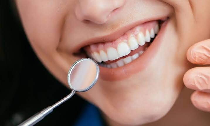 Before You Commit to Composite Bonding Middlesbrough, Read This